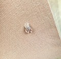 Taśma kinezjologiczna do tapingu twarzy 2,5 cm x 5 m - nude - zdjęcie 10