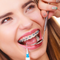 Lusterko stomatologiczne dentystyczne ze stali nierdzewnej - zdjęcie 3