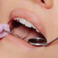 Lusterko stomatologiczne dentystyczne ze stali nierdzewnej - zdjęcie 7