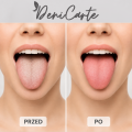 Deni Carte Czyścik 11928 przed i po